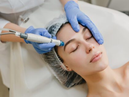 Q-Switch Lazer İle Cilt Yenileme